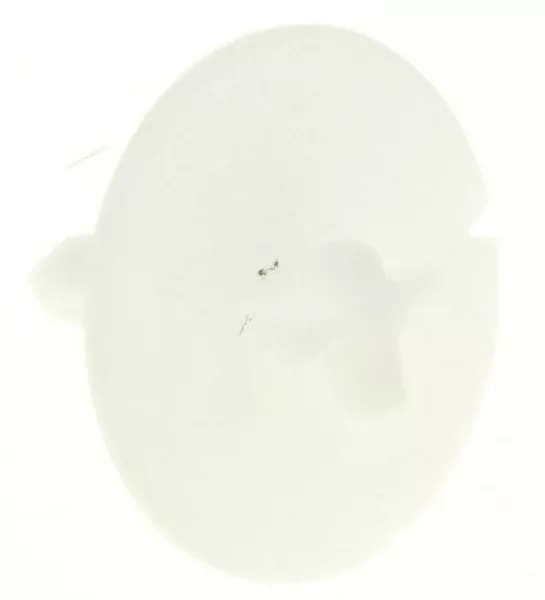 🛠️ Redukce knoflíku sušiček prádla Bosch Siemens (00183856)